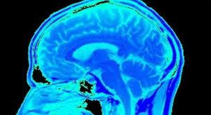 Medical breakthrough for multiple sclerosis sufferers