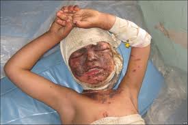 Afghan Children Dead After US Air Assault: Report